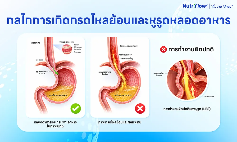 อาหารที่คลายกล้ามเนื้อหูรูดหลอดอาหาร