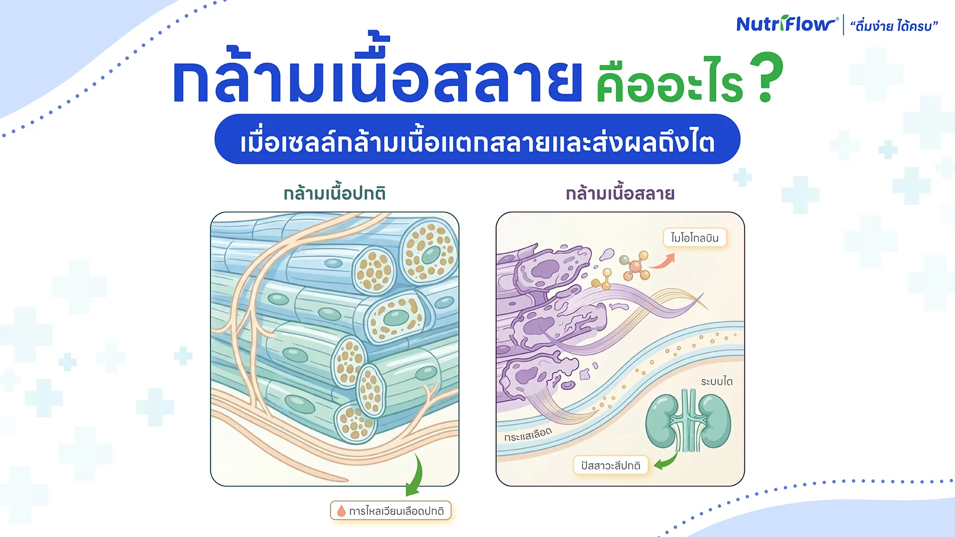 กล้ามเนื้อสลาย คืออะไร อาการและสัญญาณเตือนที่ต้องรู้
