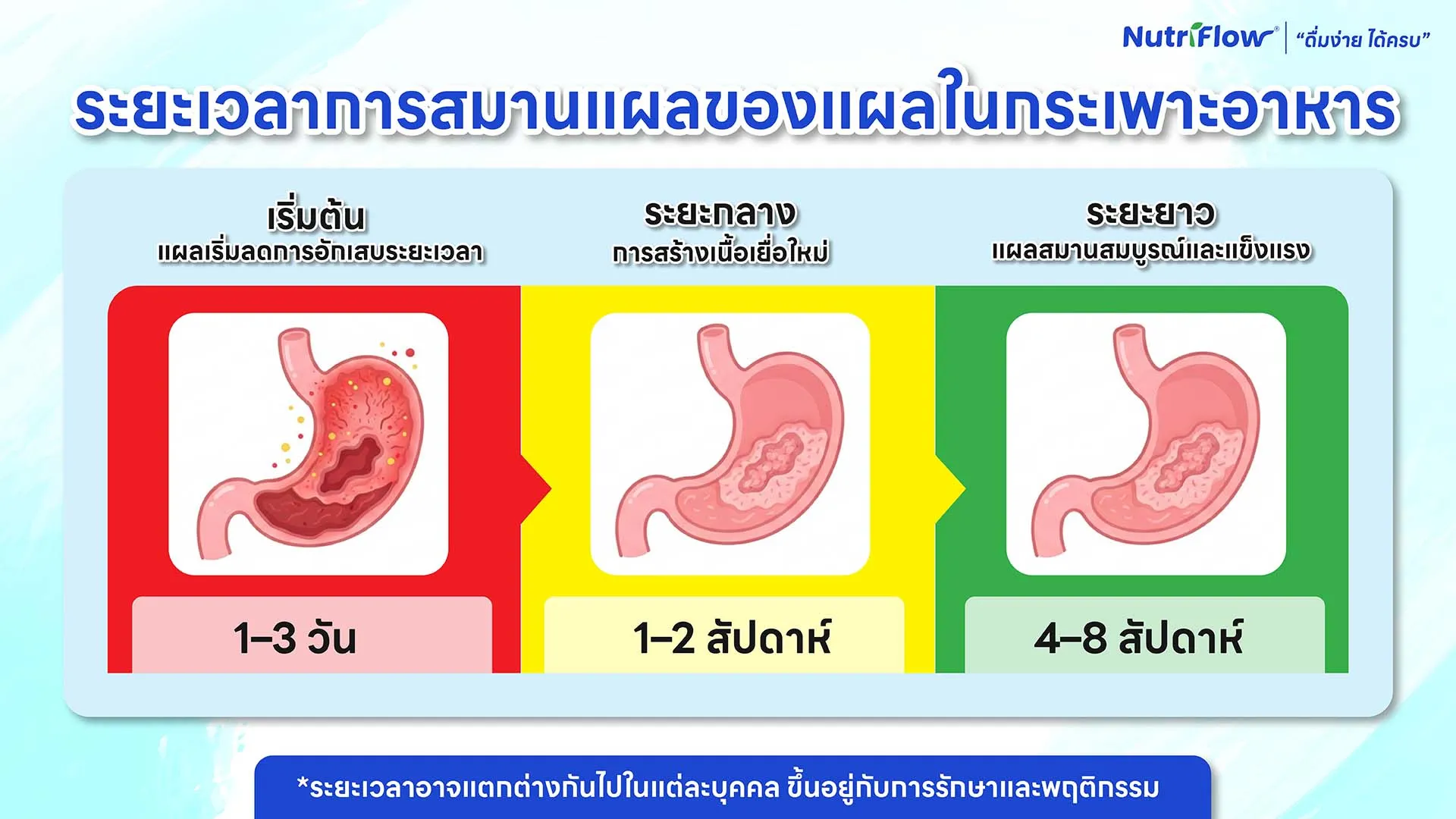 โรคกระเพาะ กี่วันหาย ระยะเวลาที่ควรรู้